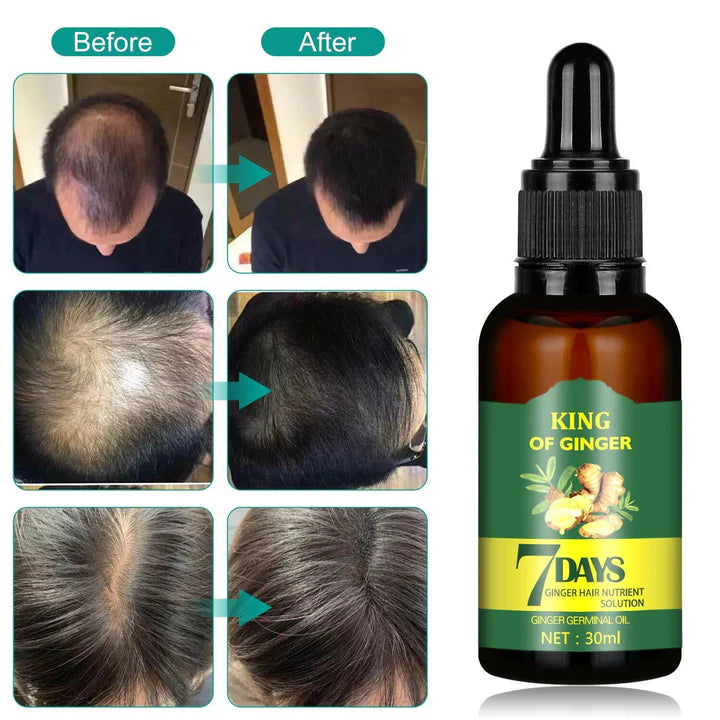 (BUY 1 GET 1 FREE)HAIR GROWTH GINGER OIL 7 DAYS (Fee delivery)